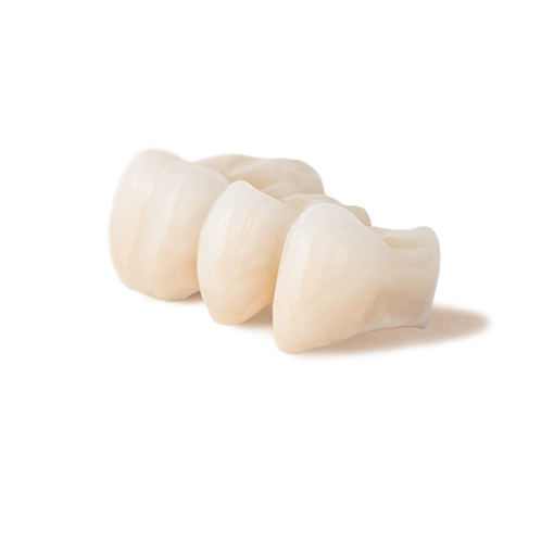 Temple City dental crowns Temple City dental crowns