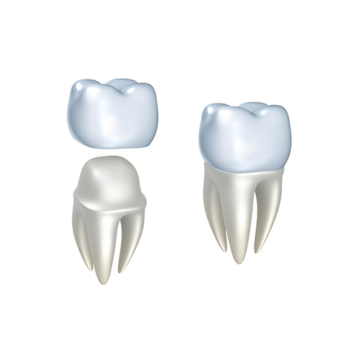 children and dental crowns children and dental crowns