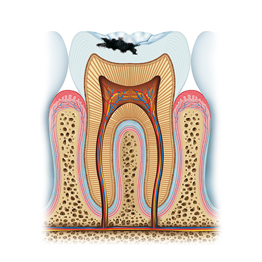 dental fillings and treatment dental fillings and treatment